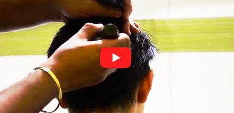 Hair Transplant Abroad - Adelaide Hairdresser 4